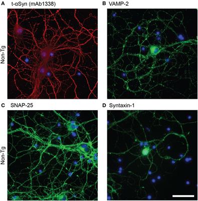 In Situ Proximity Ligation Assay Reveals Co-Localization of Alpha-Synuclein and SNARE Proteins in Murine Primary Neurons